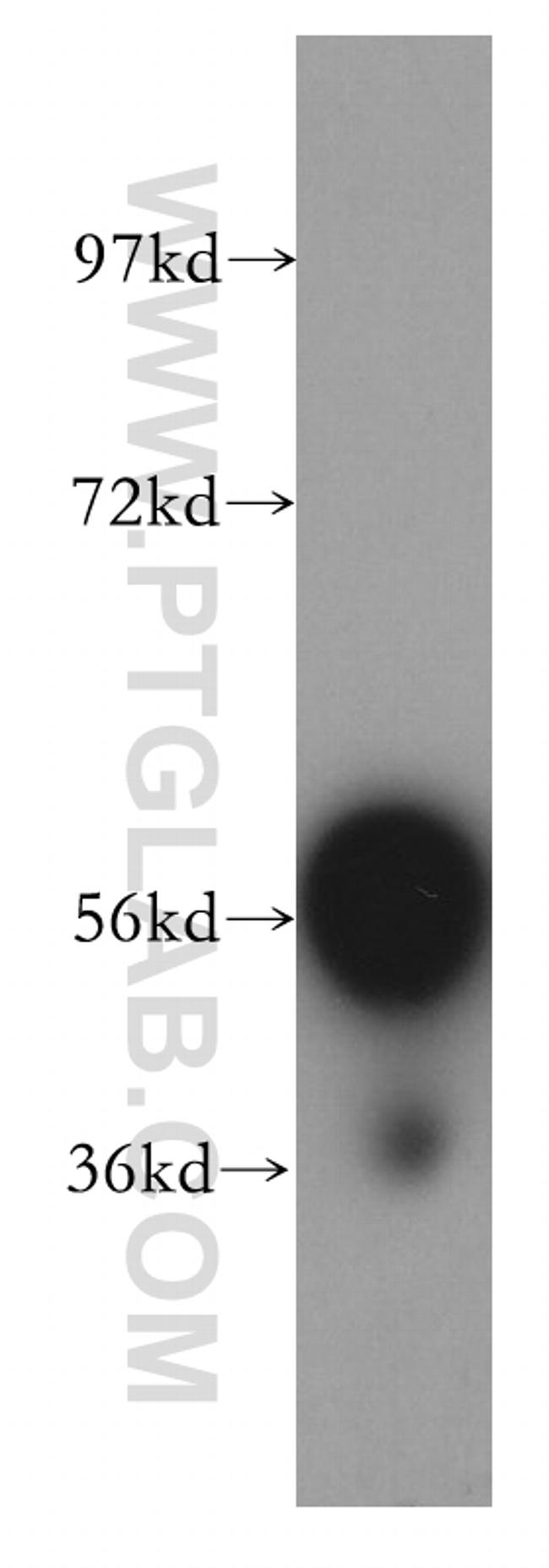 TBX6 Antibody in Western Blot (WB)