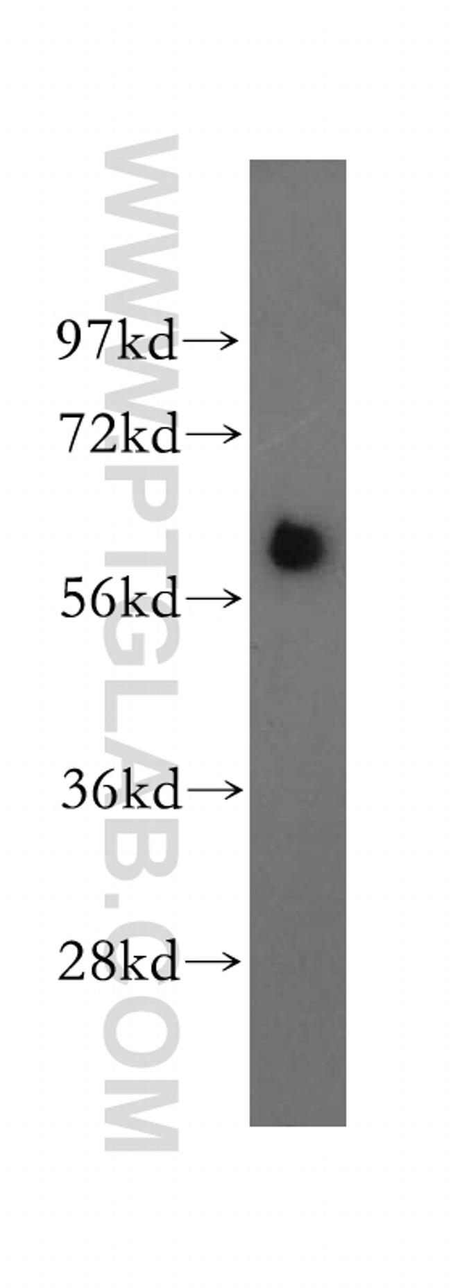 TBX6 Antibody in Western Blot (WB)