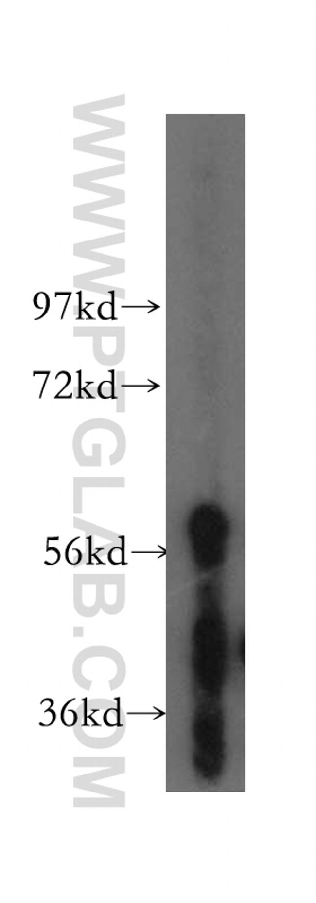 TBX6 Antibody in Western Blot (WB)