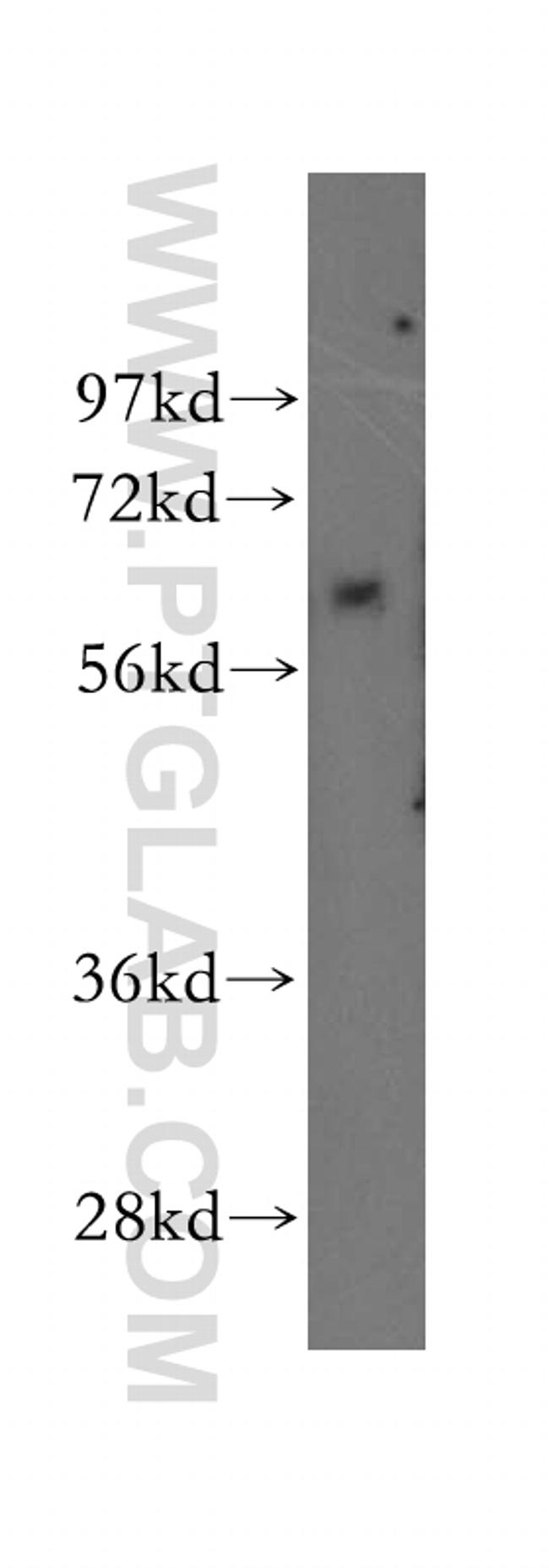 TBX6 Antibody in Western Blot (WB)