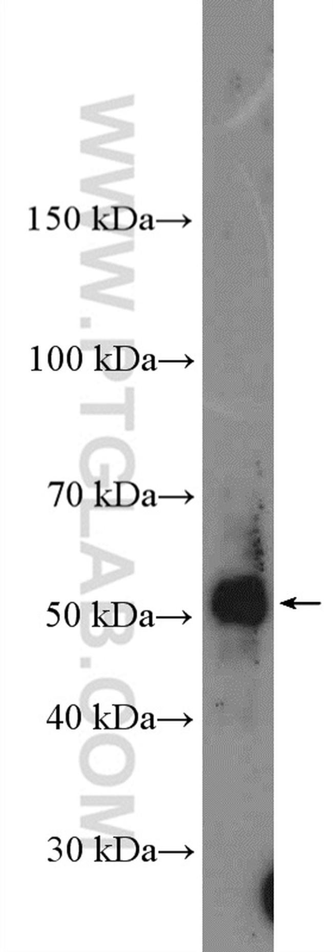 TBX6 Antibody in Western Blot (WB)