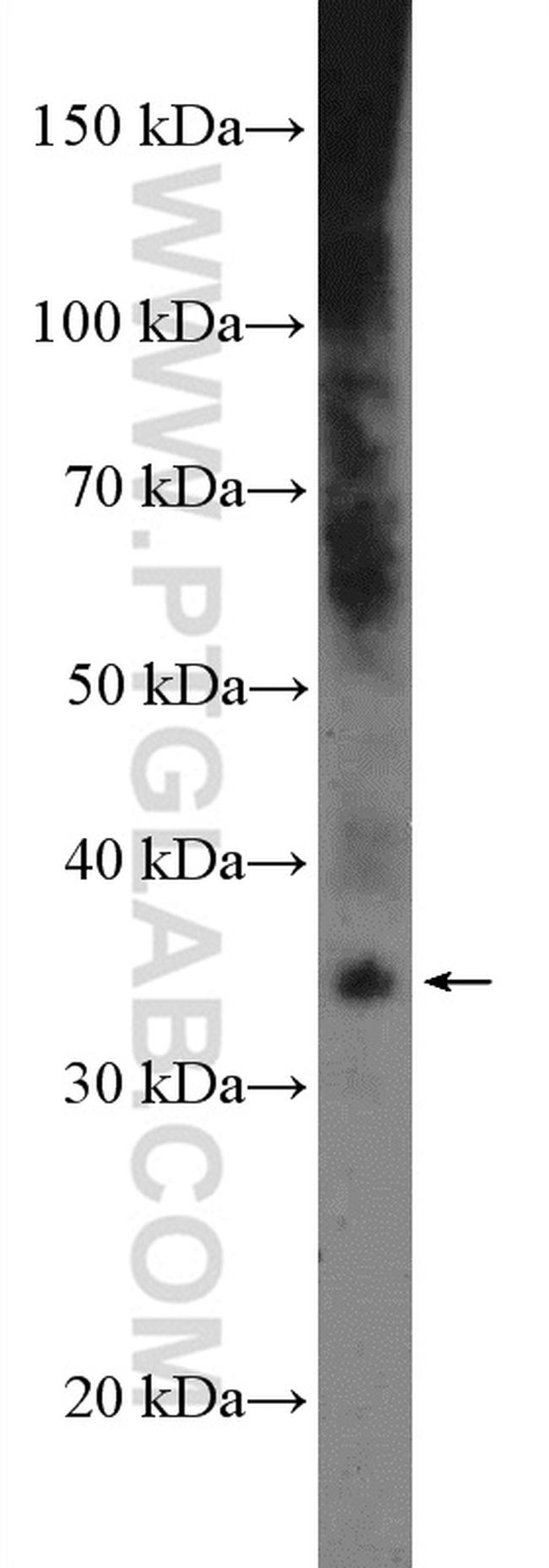 MEOX2 Antibody in Western Blot (WB)