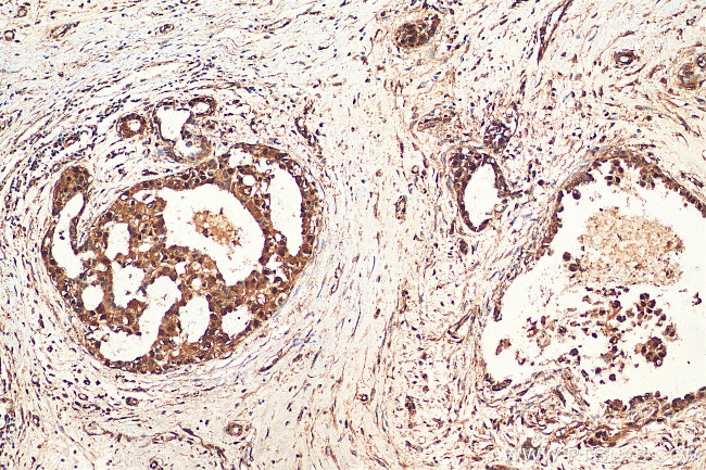 TCEB1 Antibody in Immunohistochemistry (Paraffin) (IHC (P))