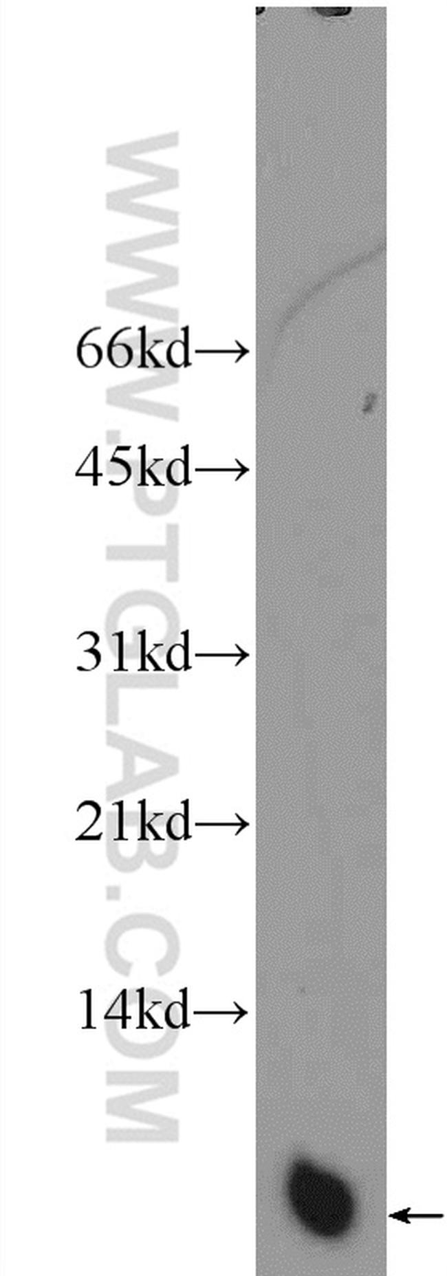 TCEB1 Antibody in Western Blot (WB)