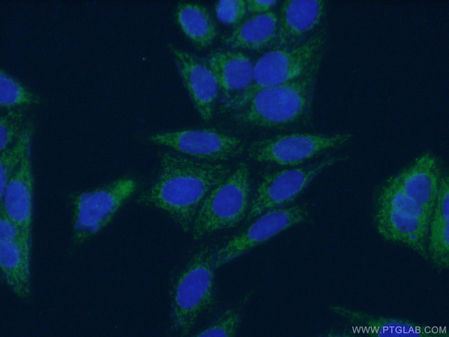 DBT Antibody in Immunocytochemistry (ICC/IF)