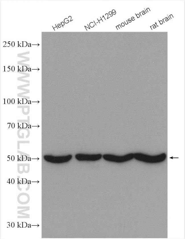 DBT Antibody in Western Blot (WB)