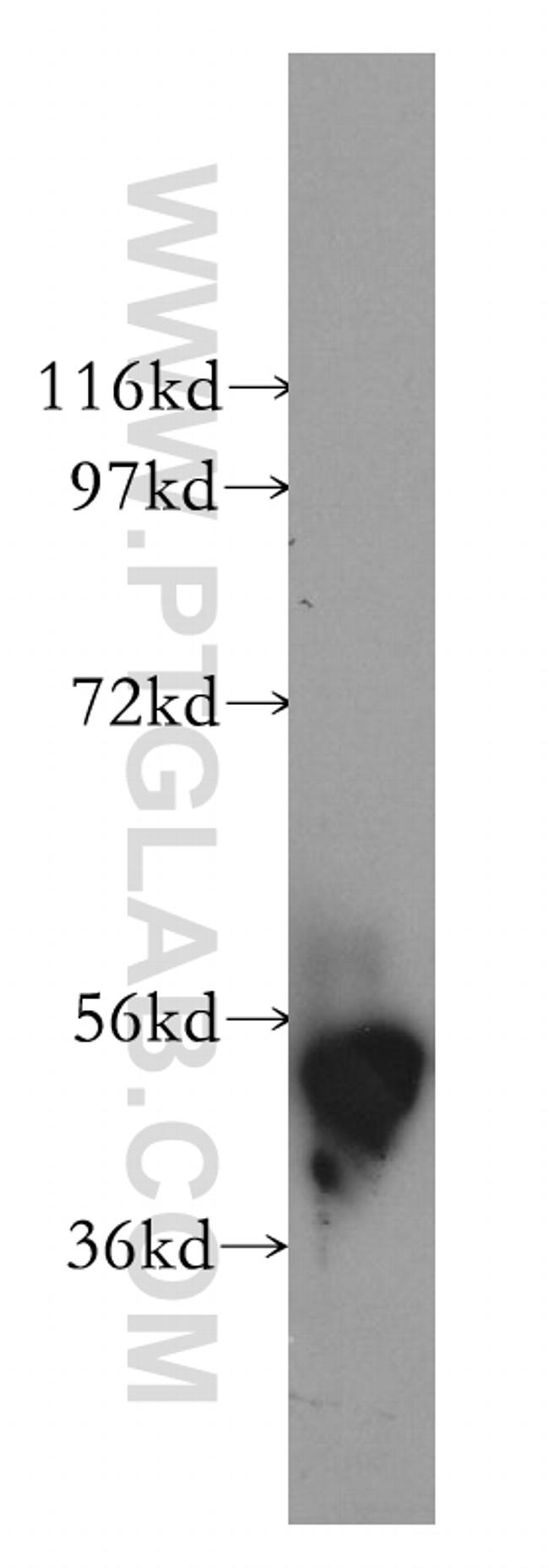 DBT Antibody in Western Blot (WB)