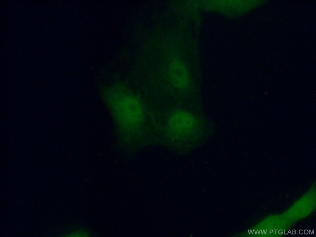 PDCD5 Antibody in Immunocytochemistry (ICC/IF)