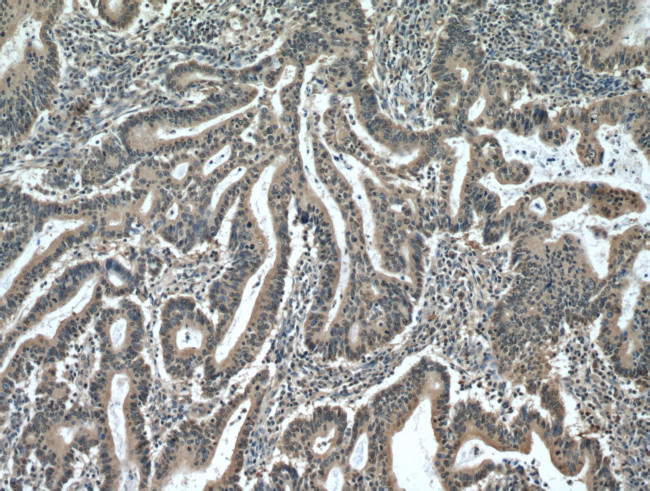 PDCD5 Antibody in Immunohistochemistry (Paraffin) (IHC (P))