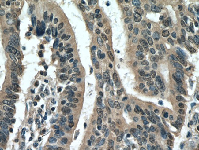 PDCD5 Antibody in Immunohistochemistry (Paraffin) (IHC (P))