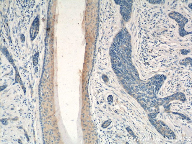 PDCD5 Antibody in Immunohistochemistry (Paraffin) (IHC (P))