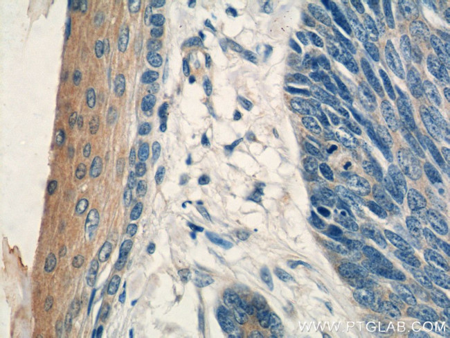 PDCD5 Antibody in Immunohistochemistry (Paraffin) (IHC (P))