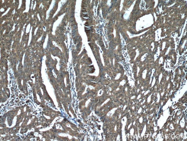 PDCD5 Antibody in Immunohistochemistry (Paraffin) (IHC (P))