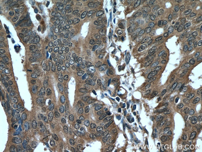 PDCD5 Antibody in Immunohistochemistry (Paraffin) (IHC (P))