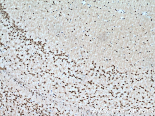 PAK4/6/7 Antibody in Immunohistochemistry (Paraffin) (IHC (P))