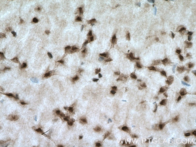 PAK4/6/7 Antibody in Immunohistochemistry (Paraffin) (IHC (P))