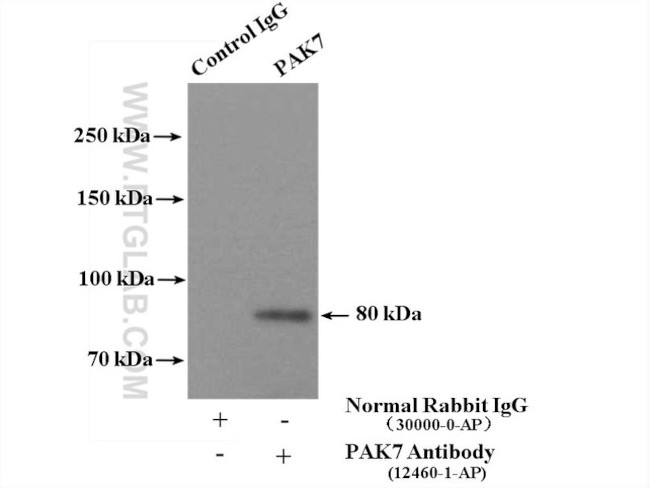 PAK4/6/7 Antibody in Immunoprecipitation (IP)