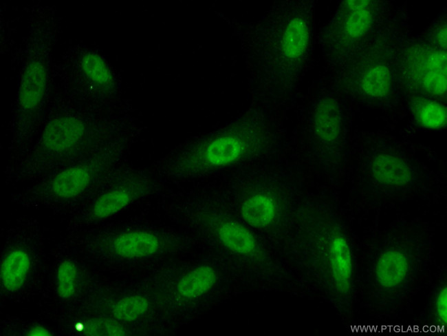 KPNA4 Antibody in Immunocytochemistry (ICC/IF)