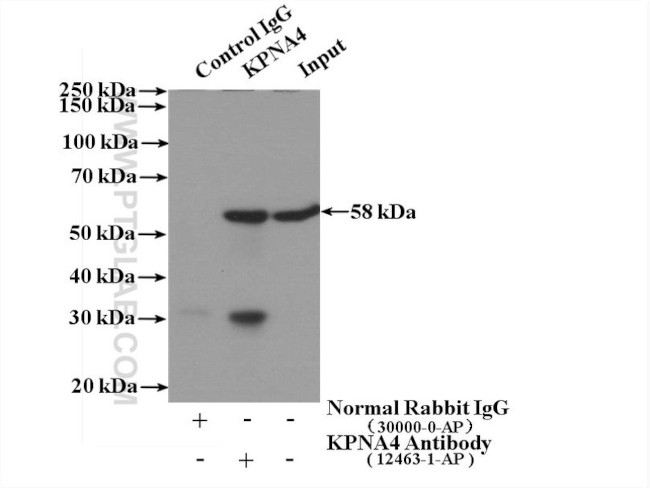 KPNA4 Antibody in Immunoprecipitation (IP)