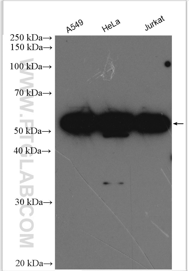 KPNA4 Antibody in Western Blot (WB)