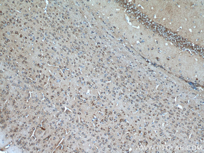 PIP4K2A Antibody in Immunohistochemistry (Paraffin) (IHC (P))