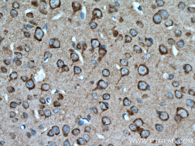 PIP4K2A Antibody in Immunohistochemistry (Paraffin) (IHC (P))