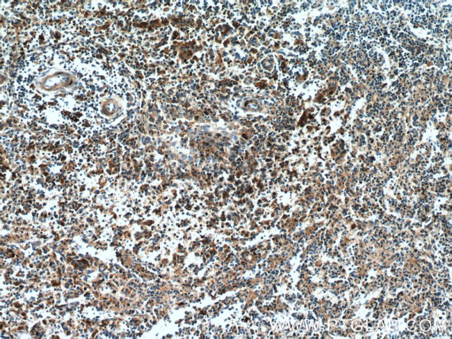 PIP4K2A Antibody in Immunohistochemistry (Paraffin) (IHC (P))