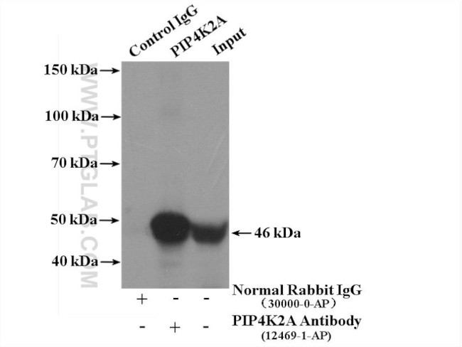 PIP4K2A Antibody in Immunoprecipitation (IP)