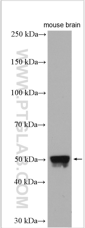 PIP4K2A Antibody in Western Blot (WB)