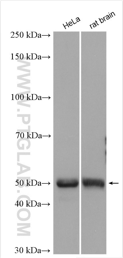 PIP4K2A Antibody in Western Blot (WB)