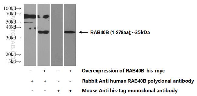 RAB40B Antibody in Western Blot (WB)