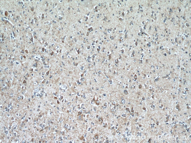 MOBP Antibody in Immunohistochemistry (Paraffin) (IHC (P))