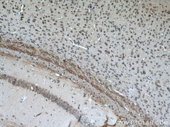 MOBP Antibody in Immunohistochemistry (Paraffin) (IHC (P))