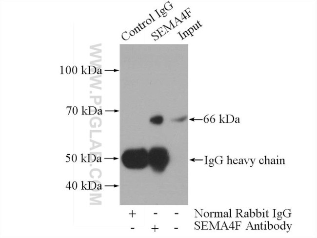 SEMA4F Antibody in Immunoprecipitation (IP)