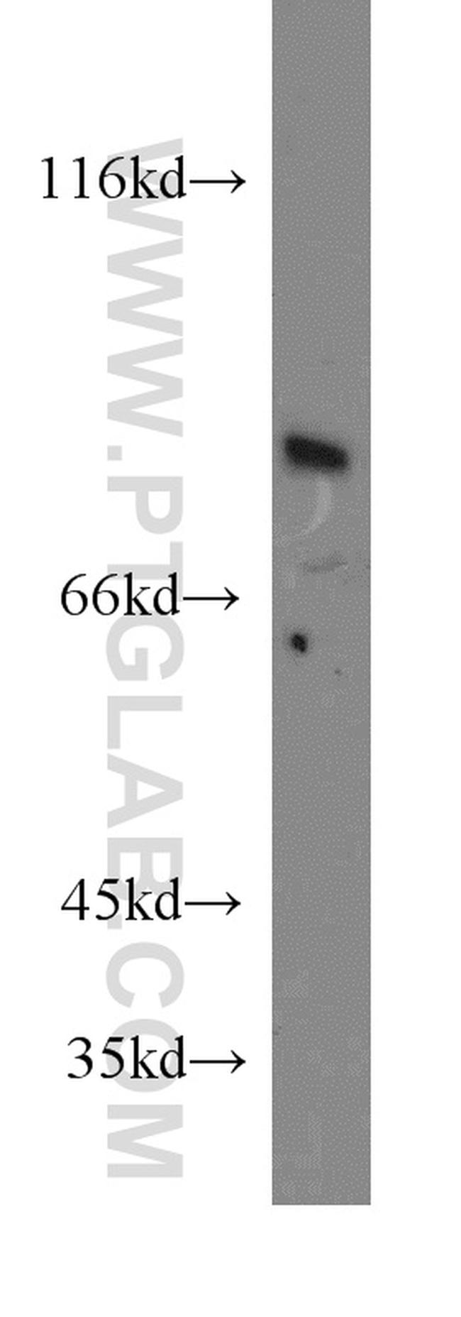 SEMA4F Antibody in Western Blot (WB)