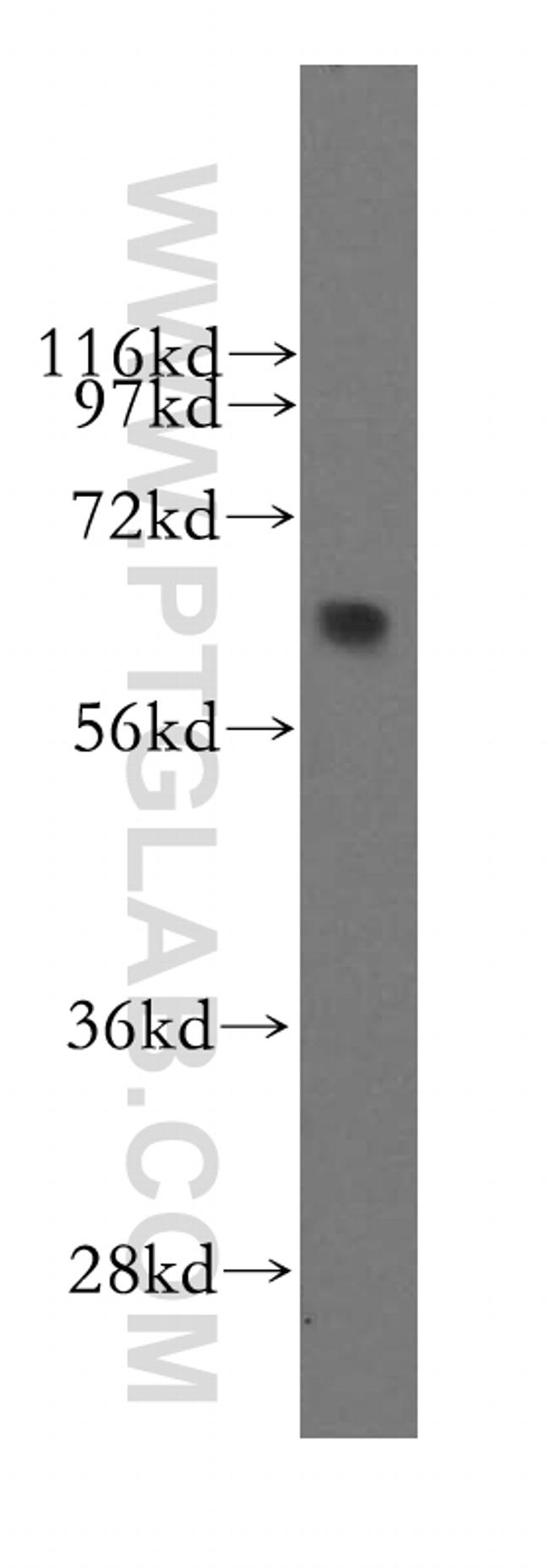 SEMA4F Antibody in Western Blot (WB)