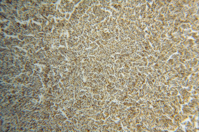 LCK Antibody in Immunohistochemistry (Paraffin) (IHC (P))