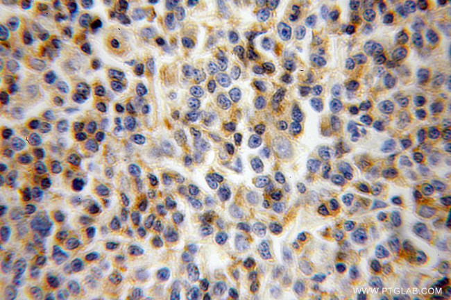 LCK Antibody in Immunohistochemistry (Paraffin) (IHC (P))