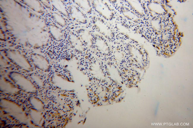 TPP1 Antibody in Immunohistochemistry (Paraffin) (IHC (P))