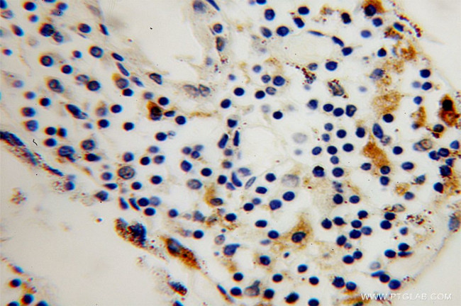 TPP1 Antibody in Immunohistochemistry (Paraffin) (IHC (P))