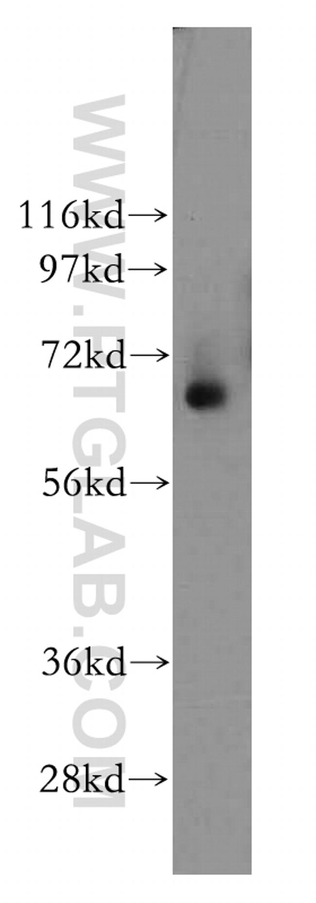 TPP1 Antibody in Western Blot (WB)