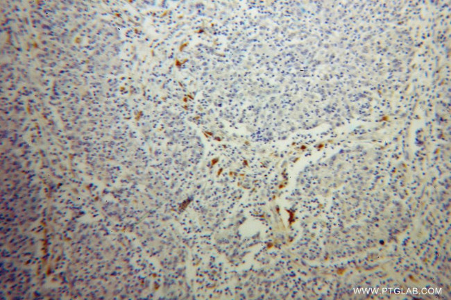 TPP1 Antibody in Immunohistochemistry (Paraffin) (IHC (P))