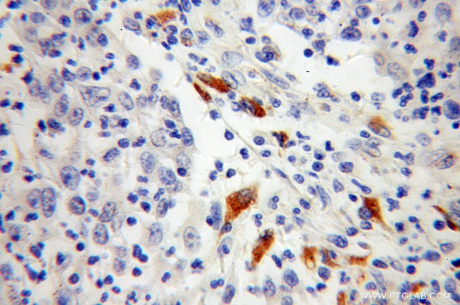 TPP1 Antibody in Immunohistochemistry (Paraffin) (IHC (P))