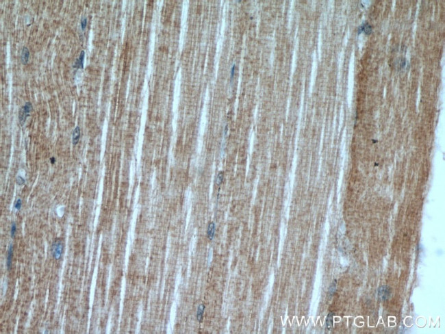 Ephrin A3 Antibody in Immunohistochemistry (Paraffin) (IHC (P))