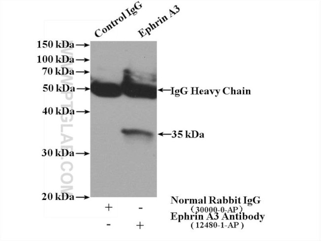 Ephrin A3 Antibody in Immunoprecipitation (IP)