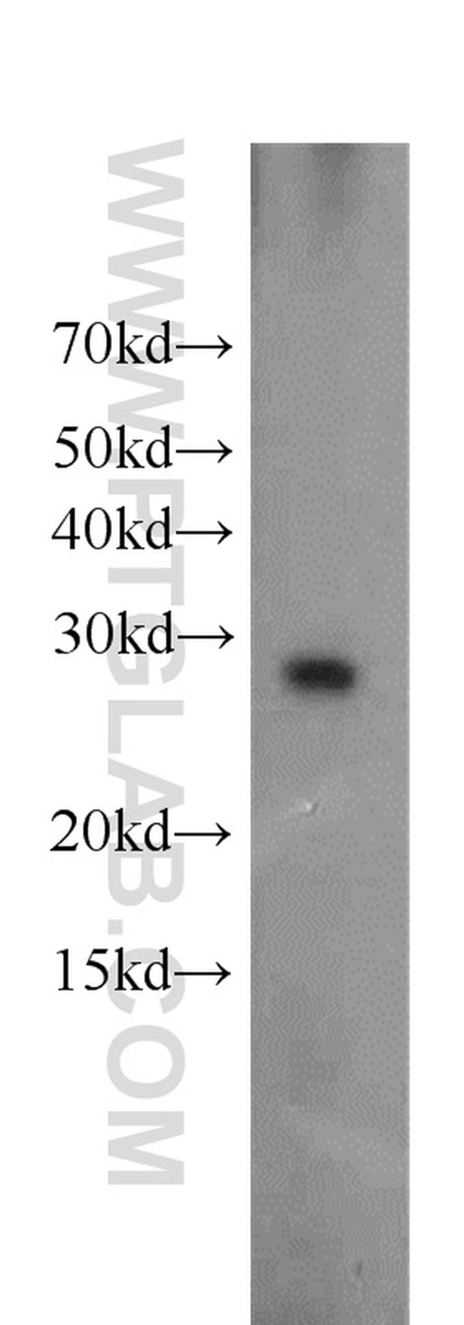 Ephrin A3 Antibody in Western Blot (WB)