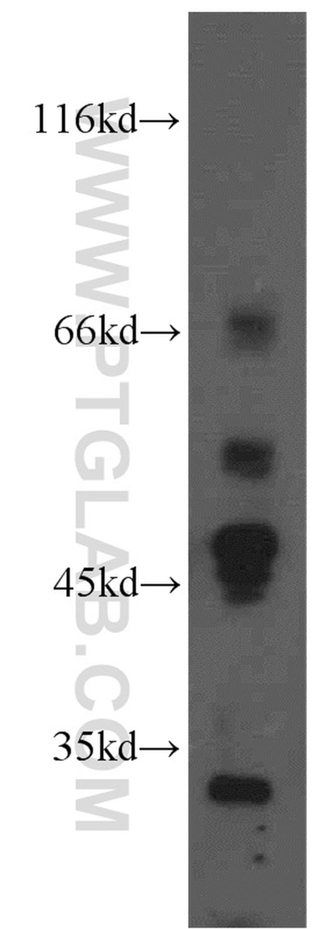 Ephrin A3 Antibody in Western Blot (WB)