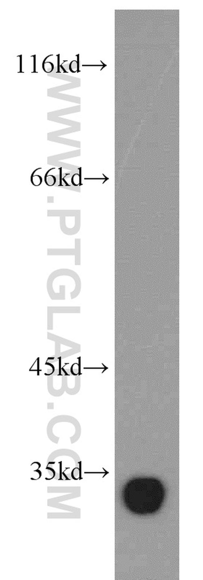 Ephrin A3 Antibody in Western Blot (WB)