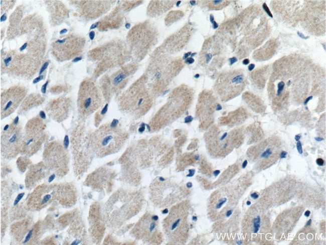 COQ6 Antibody in Immunohistochemistry (Paraffin) (IHC (P))