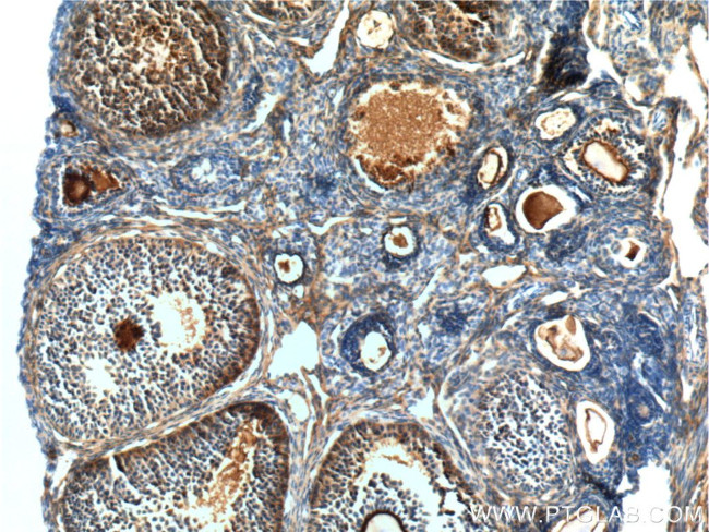 COQ6 Antibody in Immunohistochemistry (Paraffin) (IHC (P))